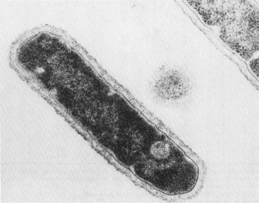 Thermus aquaticus electron micrograph